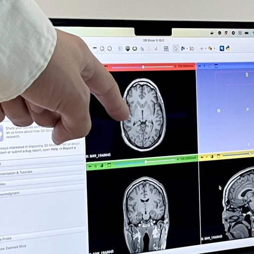 MRI