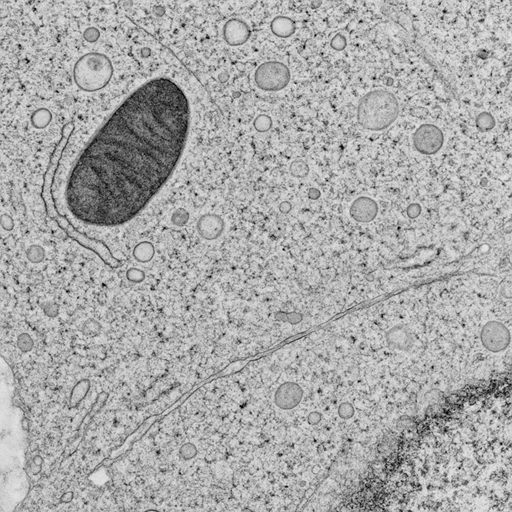 Electron microscopy