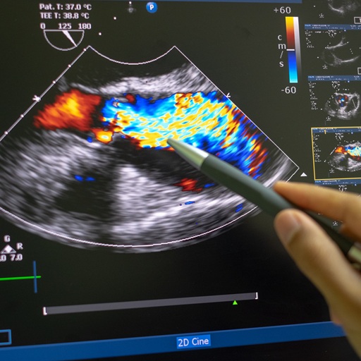 Ultrasound